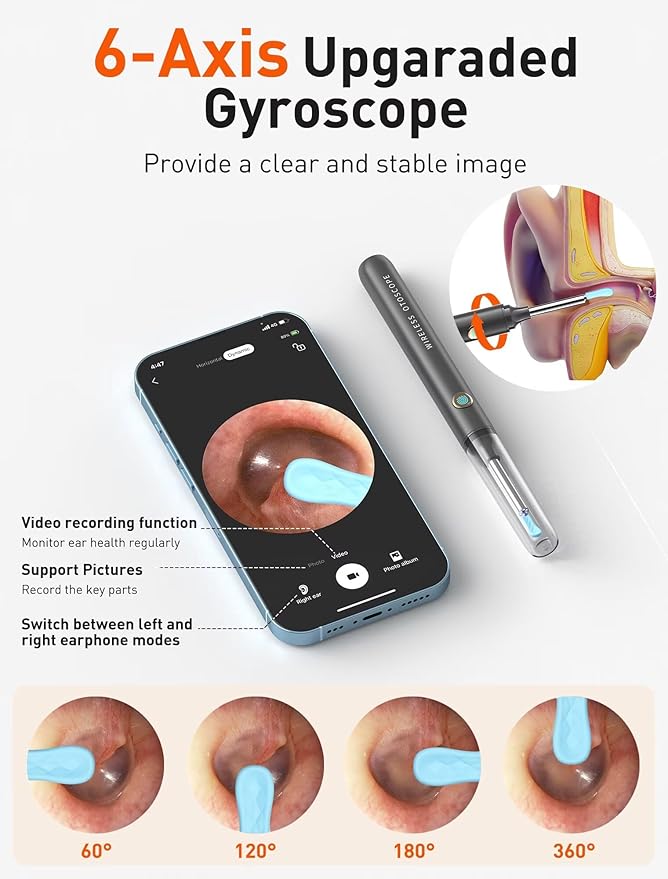 Ear Wax Removal Tool Camera - Ear Cleaner with 1080P HD Camera, FSA - HSA Store Eligible, Otoscope with Light, Earwax Removal Kit with 50 Replacement Tips for iPhone, iPad, Android Phones (Gray)