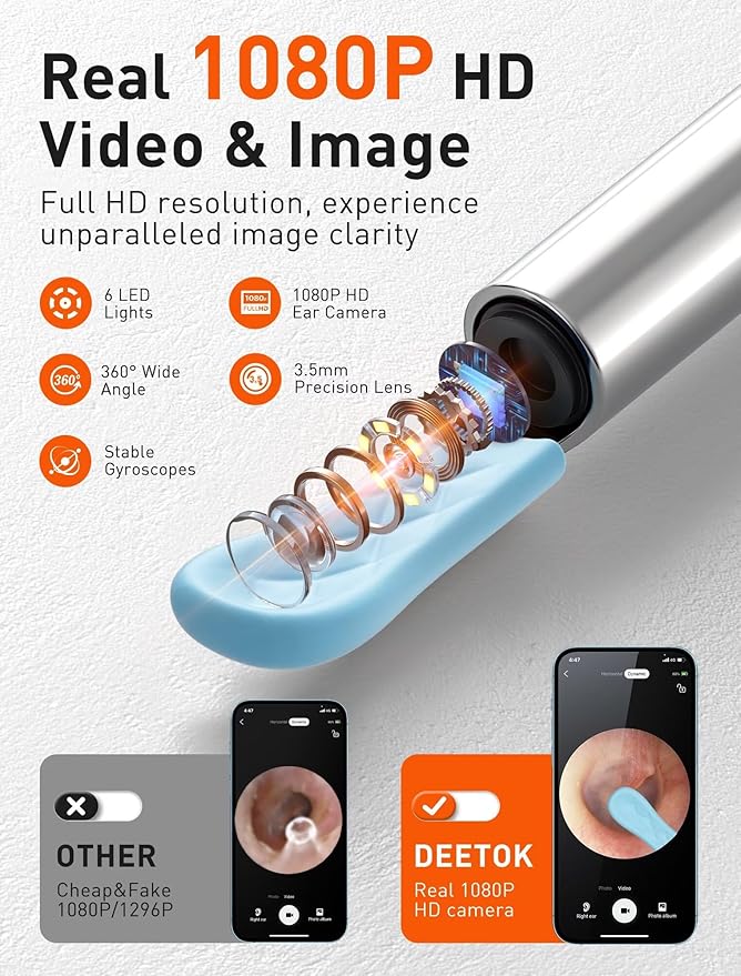 Ear Wax Removal Tool Camera - Ear Cleaner with 1080P HD Camera, FSA - HSA Store Eligible, Otoscope with Light, Earwax Removal Kit with 50 Replacement Tips for iPhone, iPad, Android Phones (Gray)